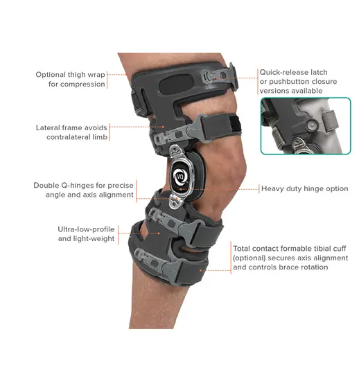 VQ Orthocare OActive Align OTS